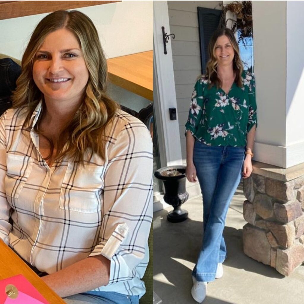 Before and after of woman who has lost weight