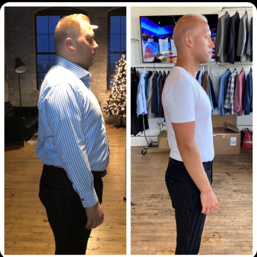 Before and after side profile of blonde man losing weight
